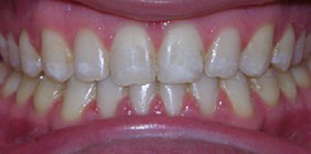 Orthognathic surgery white plains - After