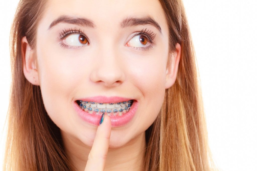 Braces Near Me Sokoloff Orthodontics
