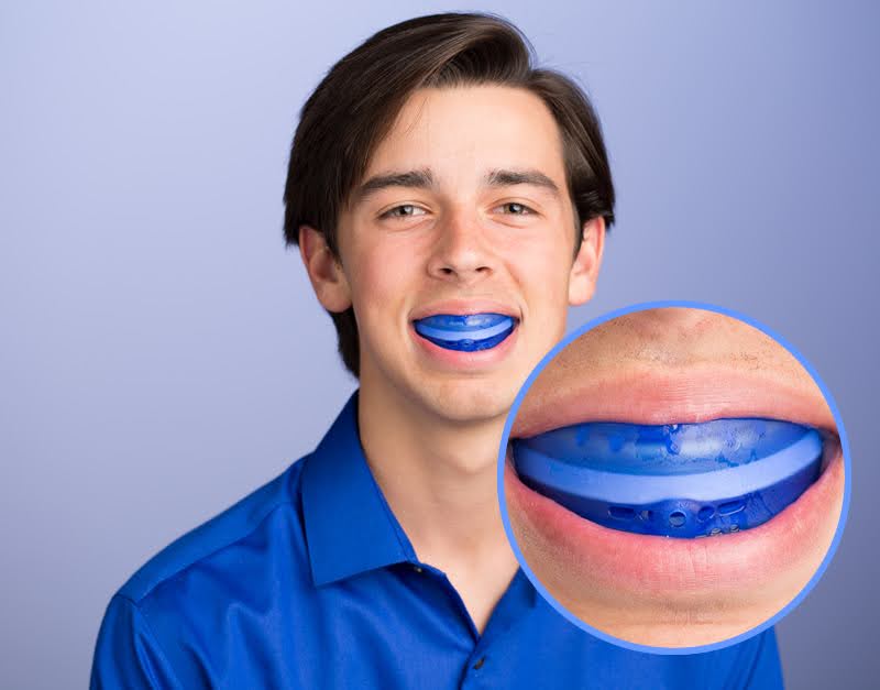 Braces mouth guard
