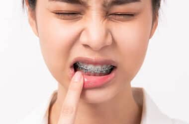 orthodontic braces adjustment discomfort