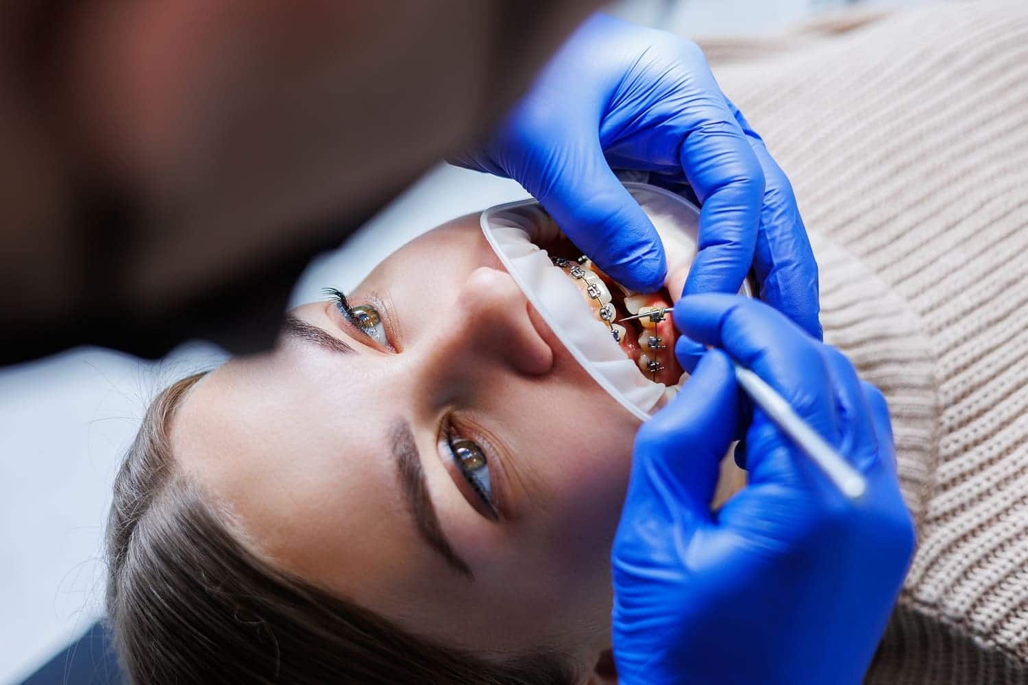 Orthodontist placing braces on a patient’s teeth