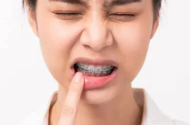 orthodontic braces adjustment discomfort